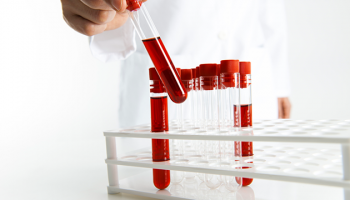 dec1-2017-ASN-iStock-MS-BloodTest_640